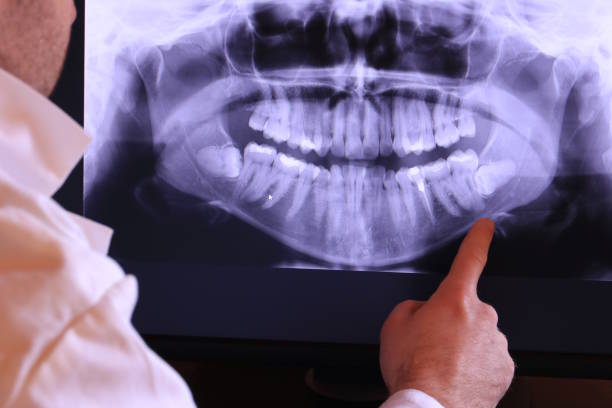 Best Pediatric Emergency Dentist in Ampere North, NJ