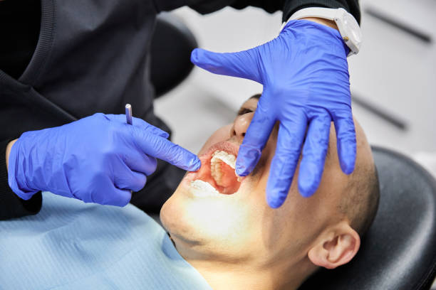Best Emergency Dental Extractions in Ampere North, NJ